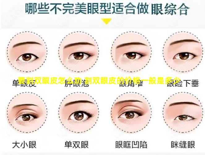 要割双眼皮怎么劝 割双眼皮的价格一般是多少
